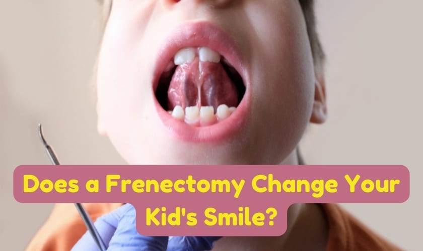 Does a Frenectomy Change Your Kids Smile