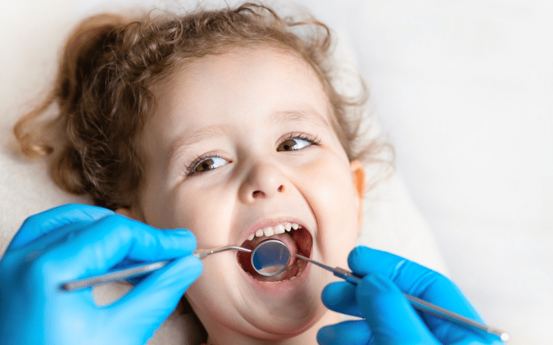 How SDF treatment Stops Decay